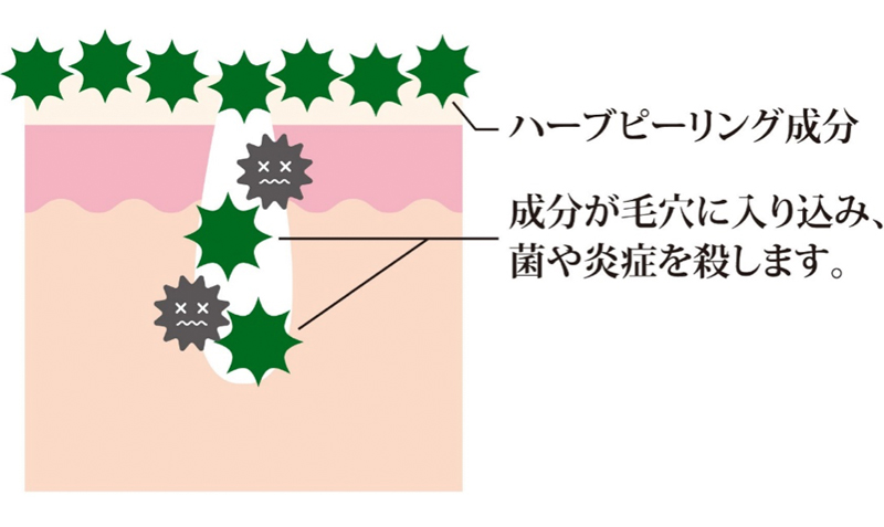 ハーブピーリング成分　成分が毛穴に入り込み、菌や炎症を殺します。